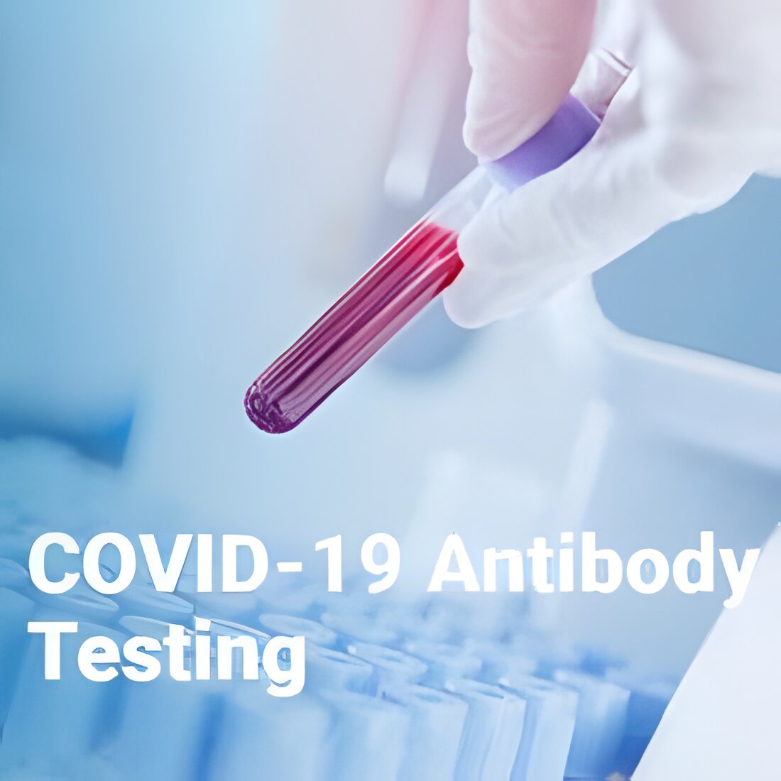 Free COVID-19 Antibody Testing